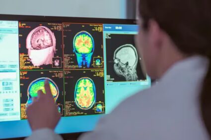 Un nuevo estudio revela que la adolescencia del cerebro puede extenderse hasta los 30 años y redefine las etapas clave de la vida